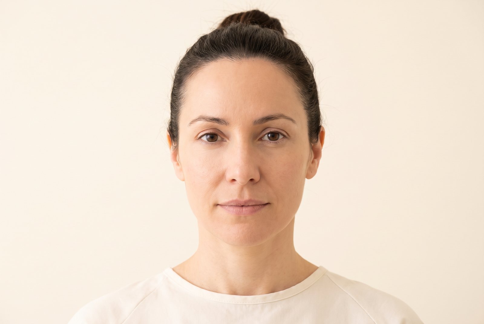 Illustrative forehead and eye-line comparison — after