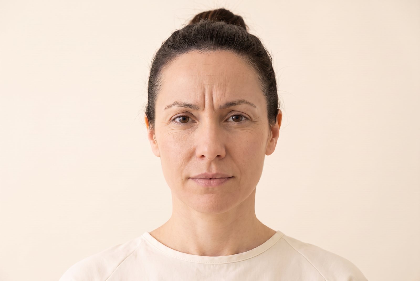 Illustrative forehead and eye-line comparison — before